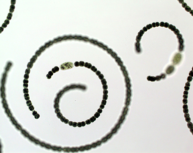 Dolichospermum circinale