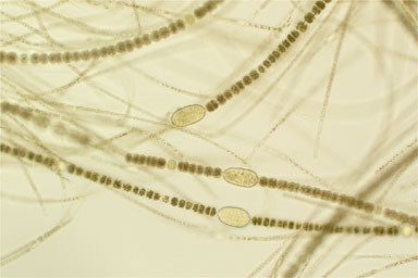 Dolichospermum planctonicum