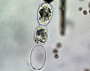 Dolichospermum planctonicum