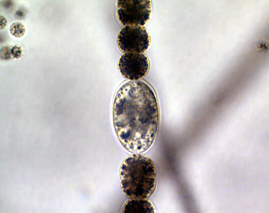 Dolichospermum planctonicum