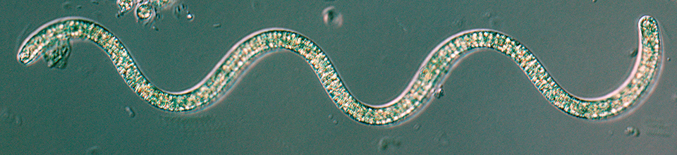 写真: アルソスピラ属（Arthospira）