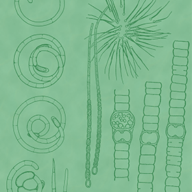 アオコをつくる藍藻