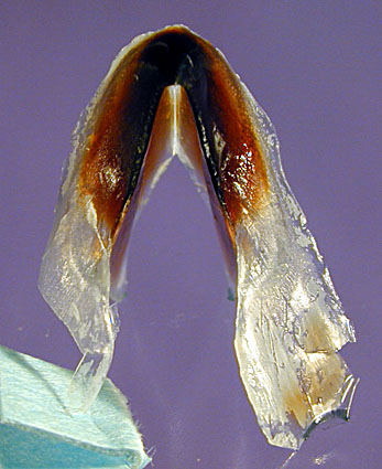 Anterior View